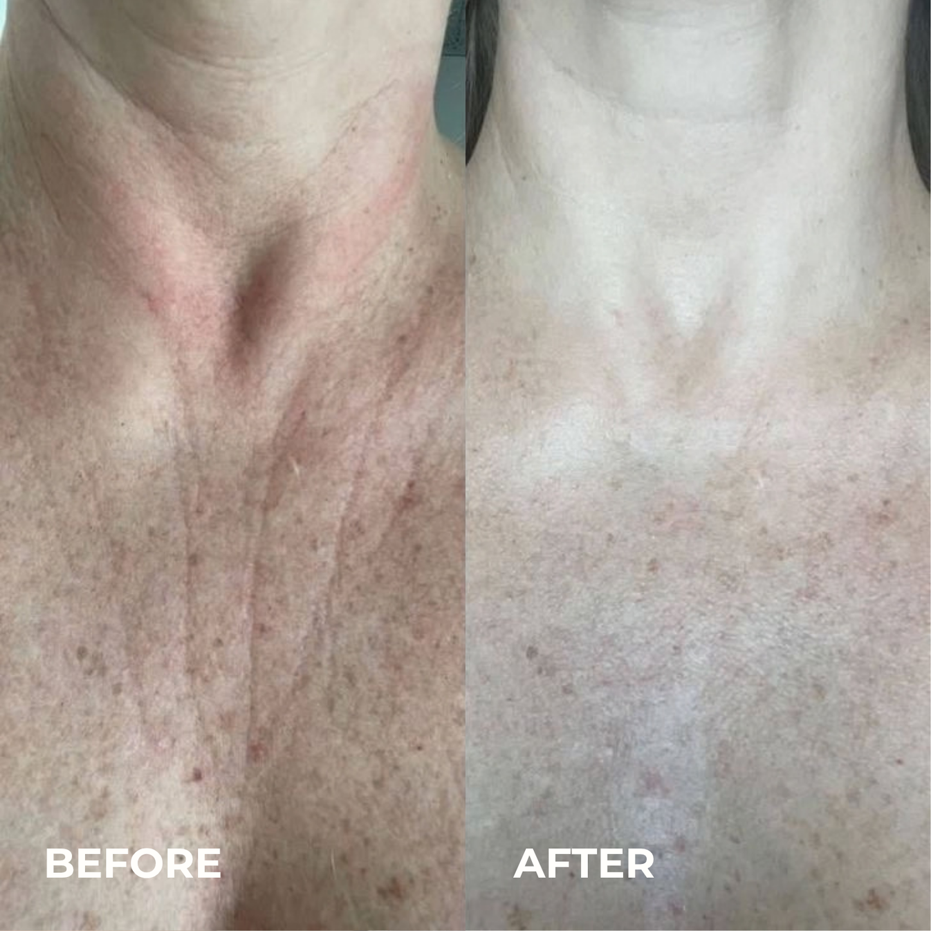 Silk Peptide EGF Toner